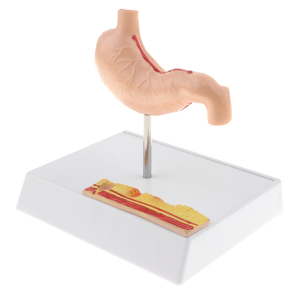 

1:1 Human Stomach Anatomical Model Kit with Base for Science Learning, School Lab Supplies Display, Medical Model