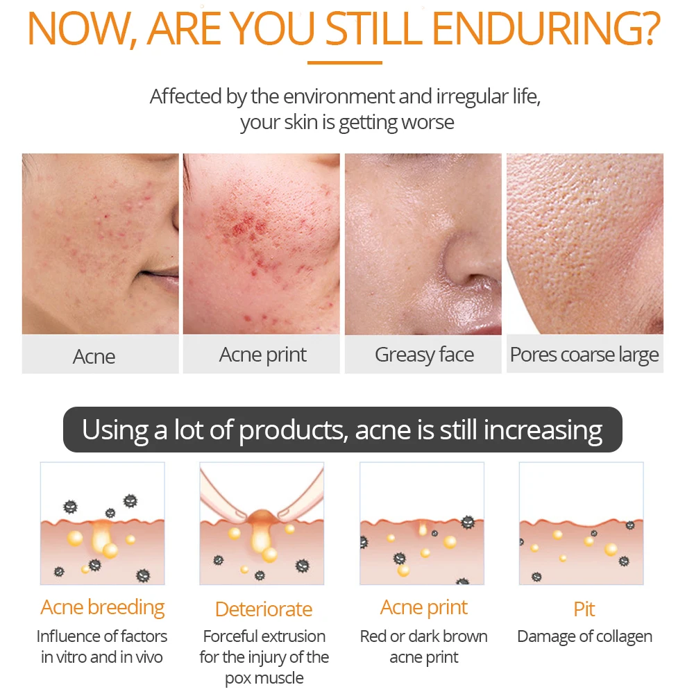 Маска для лица с салициловой кислотой увлажняющий гель сужения пор и ухода за