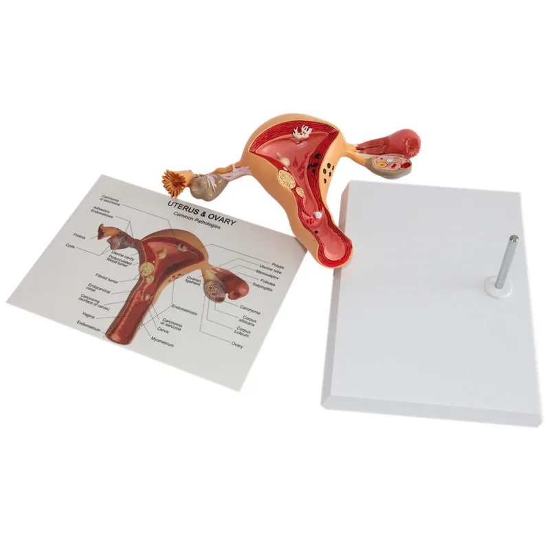 Манекены для медицинской тренировки анатомический скелет патологическая матка