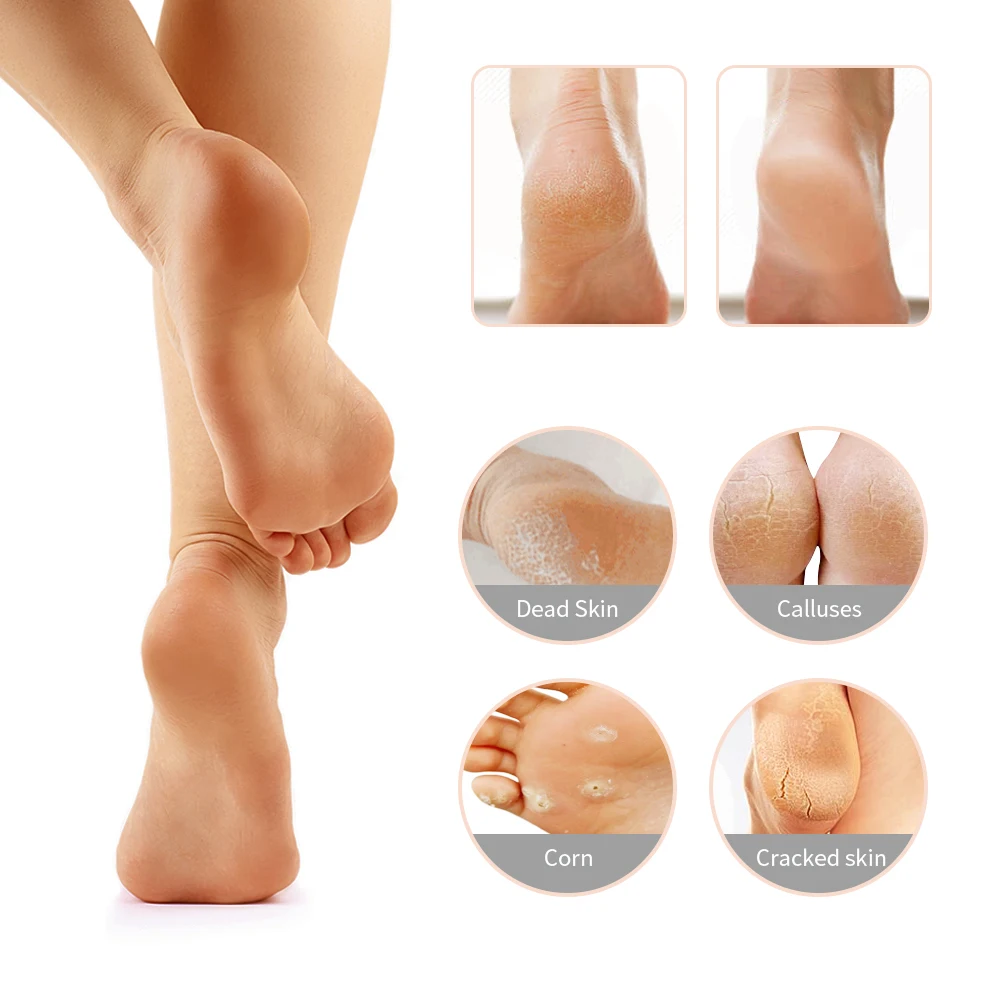 

Miss Sally 5 in 1 Professional Pedicure Foot Care Tools Foot File Rasps Callus Dead Skin Remover Stainless Steel Files