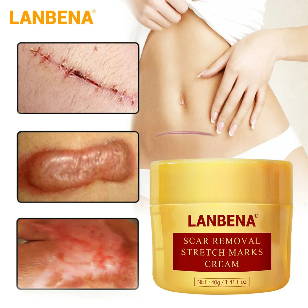 

LANBENA Scar Removal Cream Acne Treatment Repairing Scar Blackhead Shrink Pores Whitening Moisturizing Skin Care creme 40g