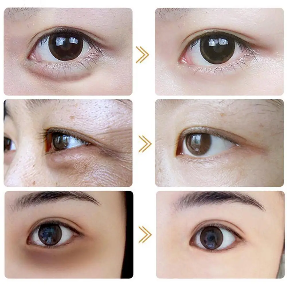 Instant Remove Eye Bags Cream Instantly Retinol Anti Wrinkles Dark Circle Aging Skin Care Firm Gel |