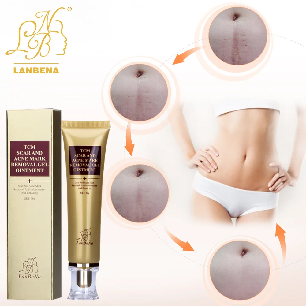 Горячая LANBENA восстанавливающий крем для удаления шрамов гель от угревой сыпи