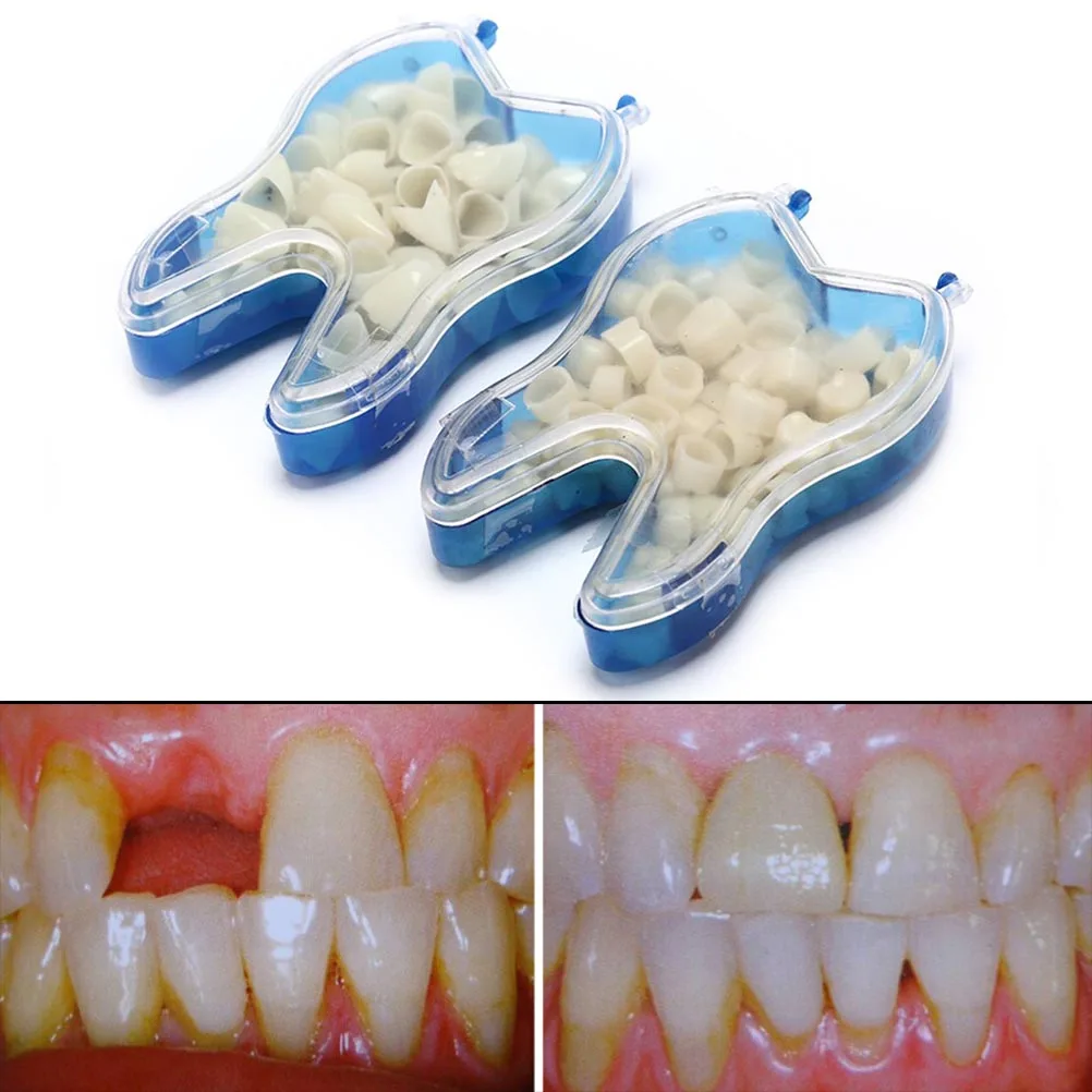 50Pcs/Box Realistic Dental Crowns Oral Teeth Whitening Anterior Molar Crown Dental Crowns Resin Porcelain Temporary Teeth crown