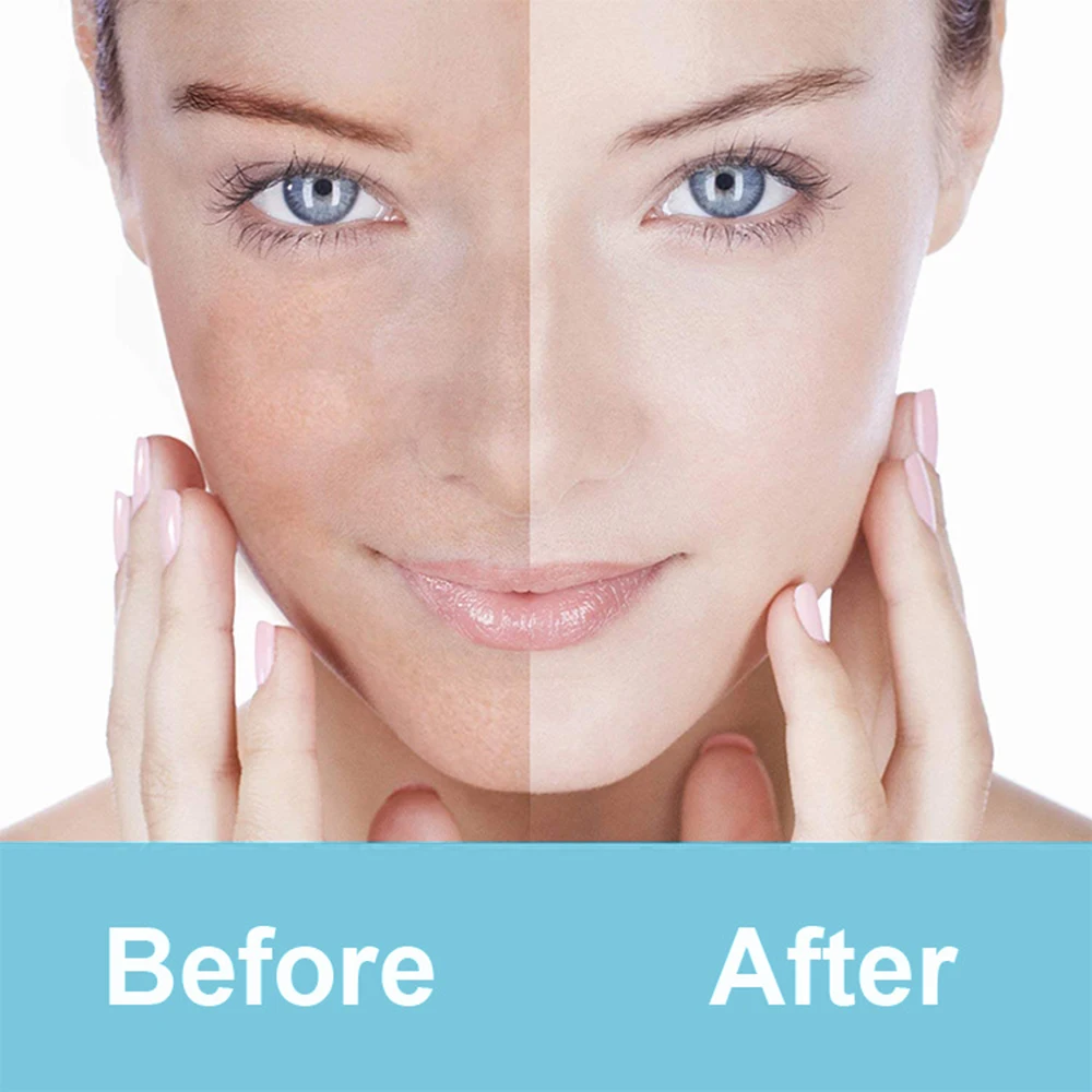 15ml Hyaluronic Acid Shrink Pore Face Serum Anti-Aging Moisturizing Whitening Essence Cream Dry Skin Care Nicotinamide Esse | Красота и