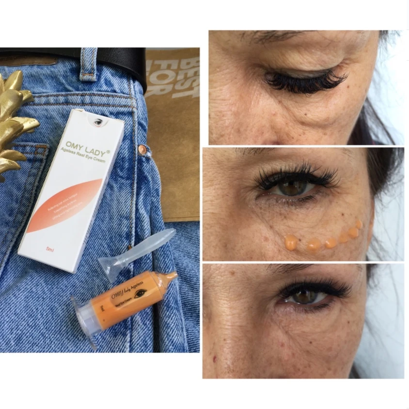 OMY LADY крем для глаз удаляет окуляры темные круги укрепляющие кожу против