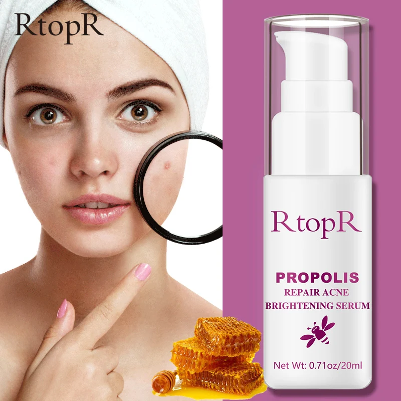 

RtopR Propolis Acne Treatment Serum Acne Scar Spots Cleaning Essence Shrink Pores Oil Control Moisturize Brighten Skin Care 20ml