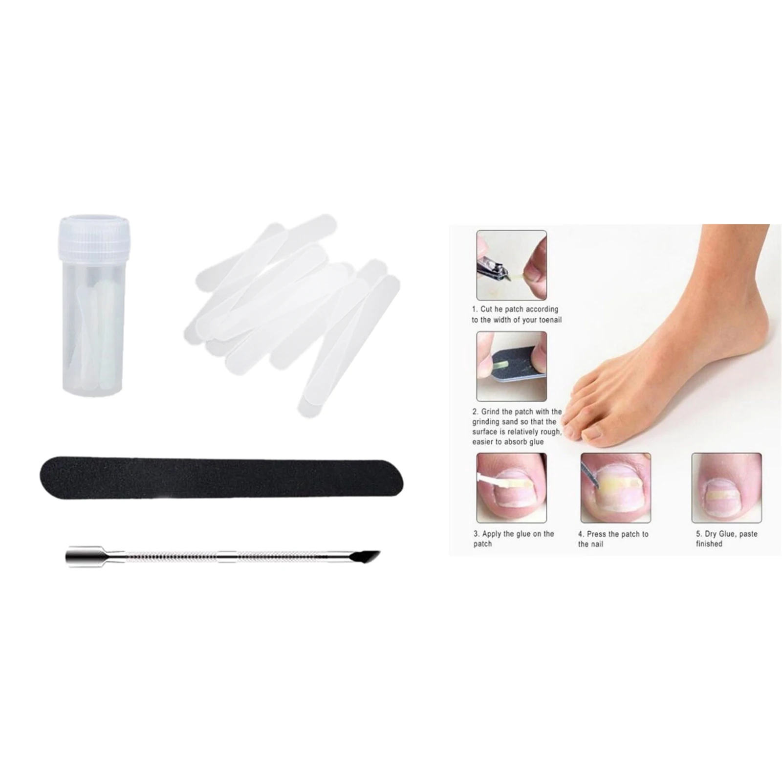 

Ingrown Toenail Straightening Clip Brace Treatment Sticker Correction Kit