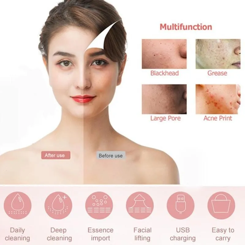 

Ultrasonic Face Cleaning Skin Scrubber Cleaner Skin Pore Scrubber Cleaner Removal Blackhead Peeling Face F3Y0