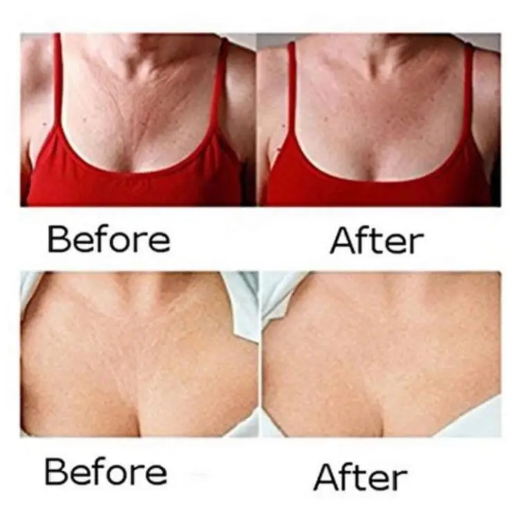 Многоразовая невидимая силиконовая подкладка против морщин медицинский силикон