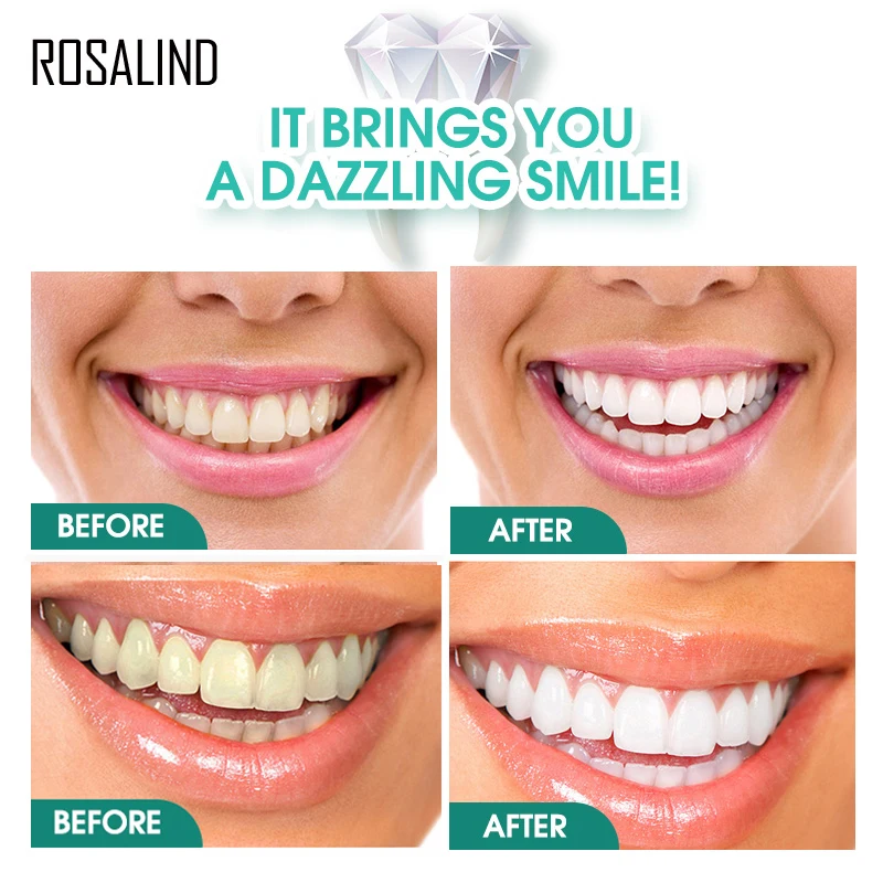 ROSALIND зубы отбеливающий для полости рта порошок активированный с активированным