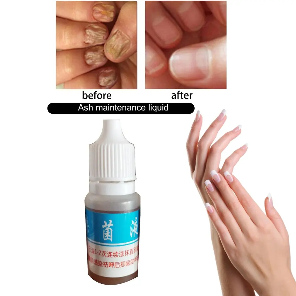 10 мл натуральный Уход за ногтями уход здоровой кожей для ухода лечение жидкое
