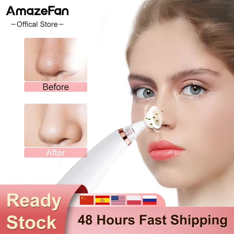 

Electric Acne Remover Blackhead Vacuum Point Noir Extractor pore cleaner Pimple Removal Suction Machine face T Zone Beauty Too