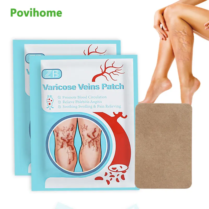 

6/24/42Pcs Varicose Veins Vasculitis Patch Spider Leg Treatment Herb Chinese Medical Plaster Relieve Phlebitis Angiitis Sticker