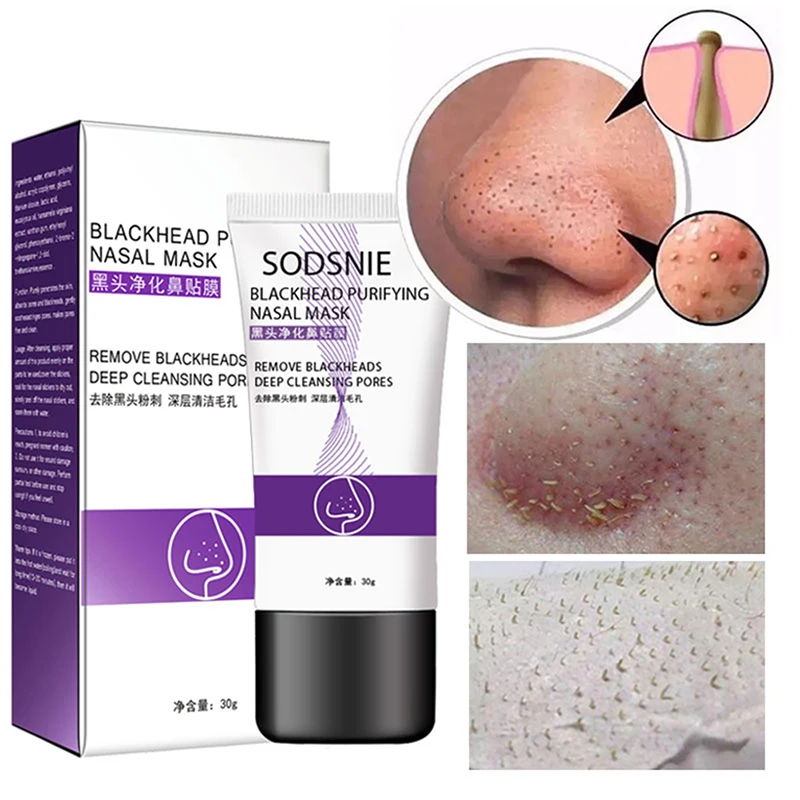 Blackhead удаление Глубокая чистка очищающий акне пилинг черная грязевая маска для