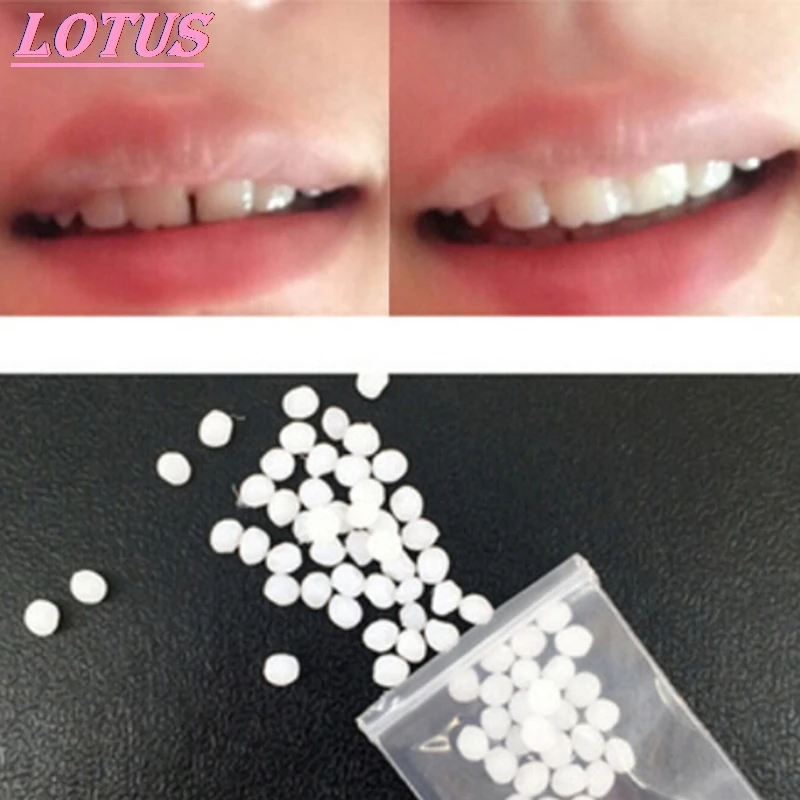

Solid glue temporary tooth restoration kit 5g /10g / 50g / 100g denture dentist