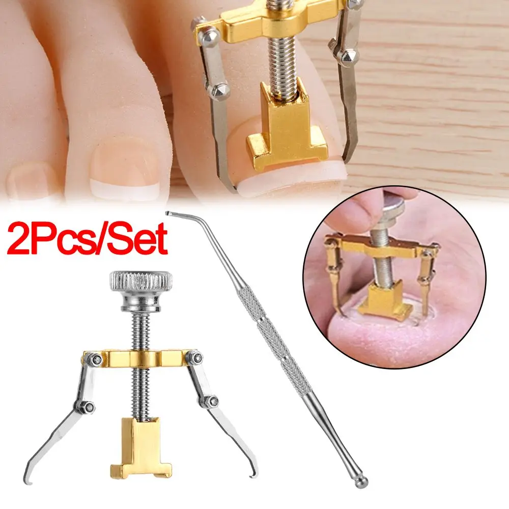 

Ingrown Toe foot Nail Correction Fixer Nail Pedicure Tool Toenail Corrector Pedicure Tools Set Paronychia Treatments Foot Care
