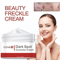 30g beauty freckle cream remove melasma acne spot pigment spots effects moisturizing cream dark whitening melanin w5b1