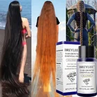 Имбирное растение для роста волос, эфирное масло для ухода за волосами, средство для укладки и выпадения волос, уход за здоровьем, красота, толстый, быстрый ремонт, растущий унисекс