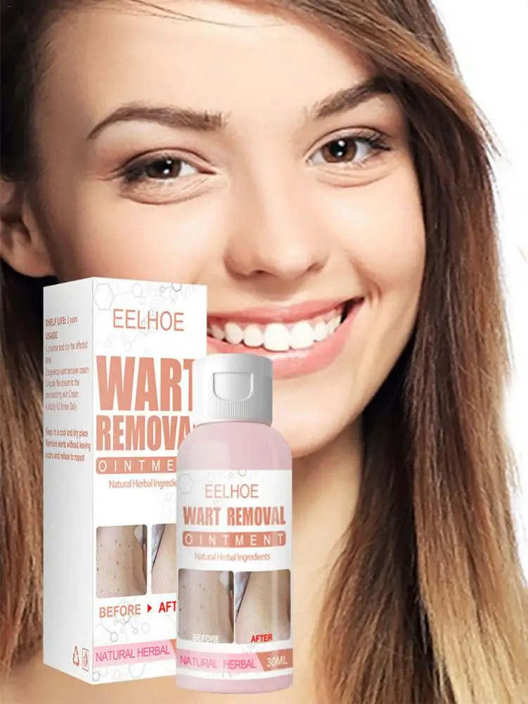 

30ml 1pcs Body Wart Remover Blemish Removal Gel Cream Skin Tag Remover Safe Painless Gentle Way To Naturally Remove