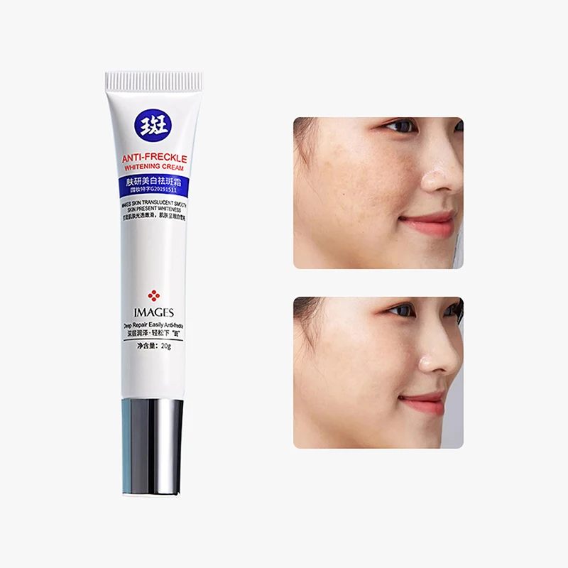 

Effective Blemish Cream Pure Skin Anti Aging Cream Freckles Moisturzing Acne Pimple Scar Dark Spots Removal Skin Care Whitening