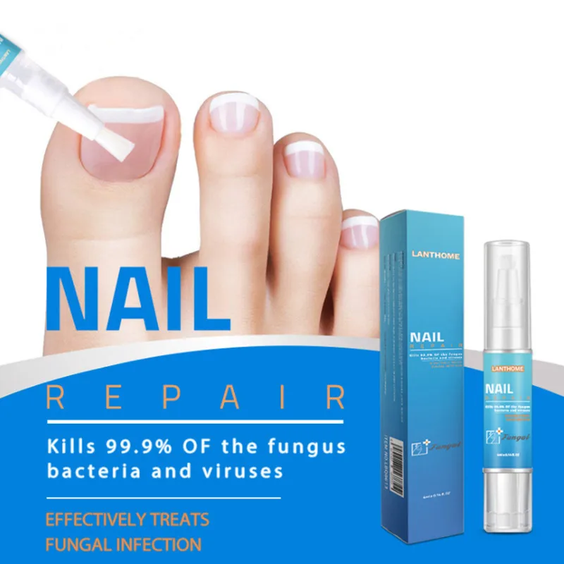 

4ml Powerful Nail Treatment Pen Onychomycosis Paronychia Anti Fungal Nail Infection Chinese Herbal Toe Fungus Care Repair Serum