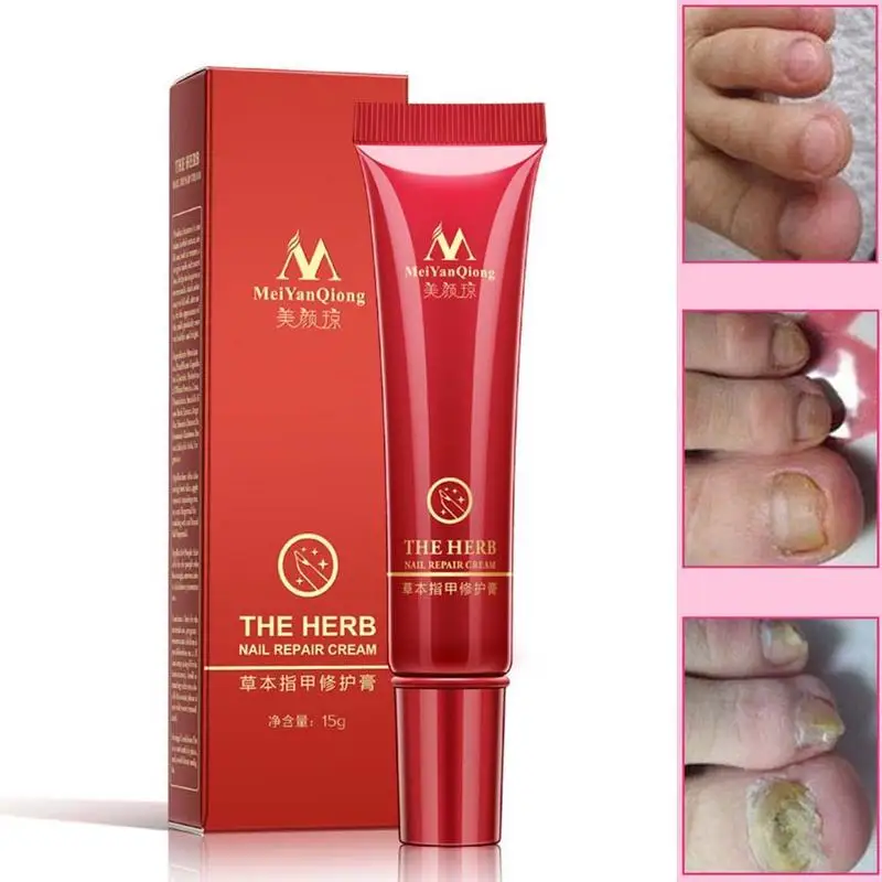 LULAA High Quality Useful Herb Nail Repair Cream Anti Nail Fungus Treatment Fungal Herb Cream Nails Tools Repair Care Nail E6Q4