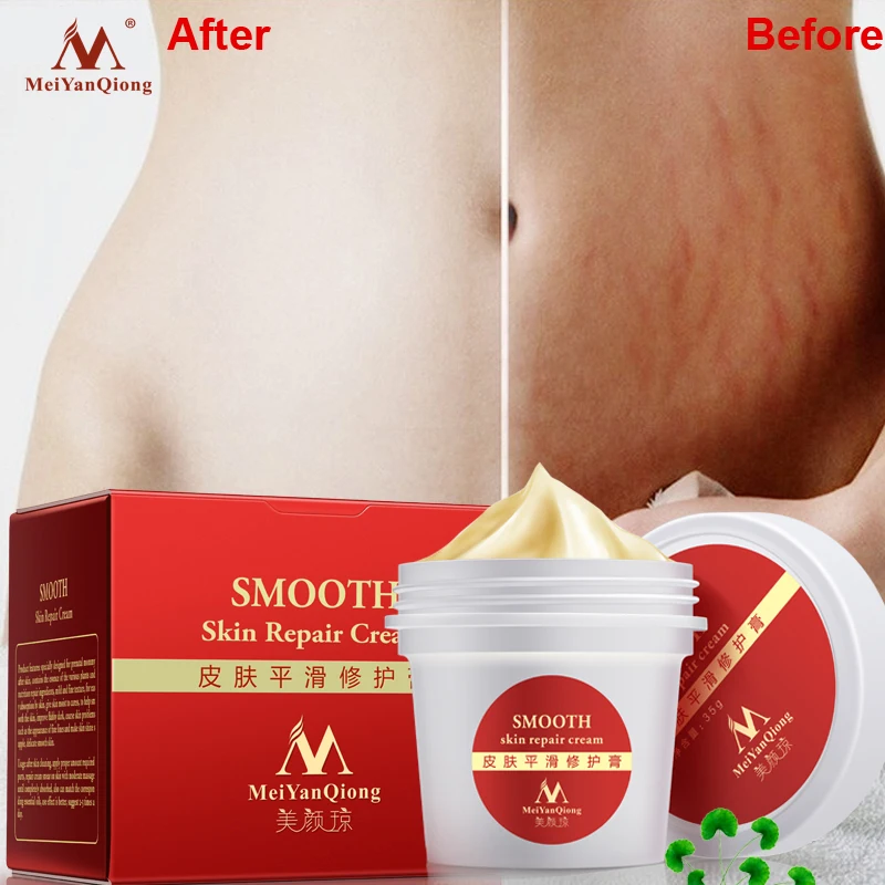 

MeiYanQiong Smooth Skin Cream Repaire Stretch Mark Remove Scars Maternity Skin Repair Body Cream Improve Rough Postpartum Care