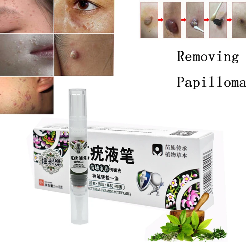 

Genital Wart Treatment Papillomas Removal Of Warts Liquid From Skin Band-Aid Removing Against Moles Remover Anti Verruca Remedy
