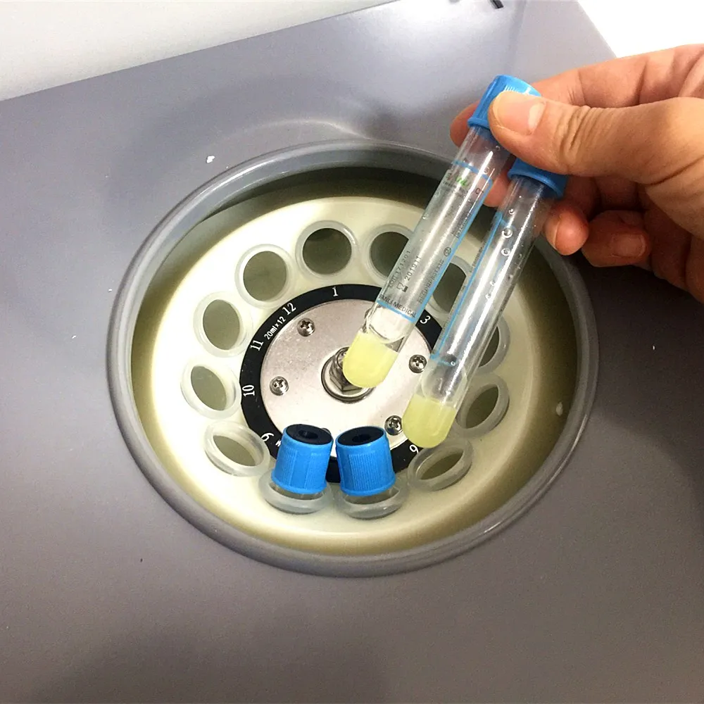 PRP центрифуга для различных наборов 8 мл 12 30 50 медицинский опыт низкая Скорость