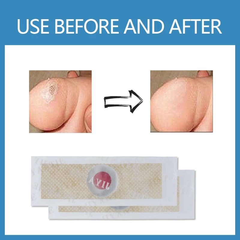 

6Pcs /12pcs Wart Removal Patch Painlessly Remove Feet Callus Cutins Corn Remover Pads Foot Care Q1