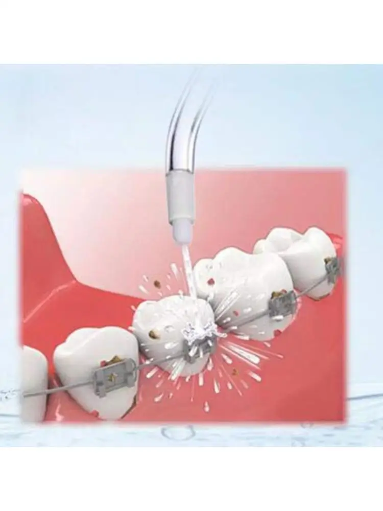 

Replacement Classic Jet Tips Dental Water Jet Nozzle Accessories for Waterpik Water Flossers and Other Oral Irrigators