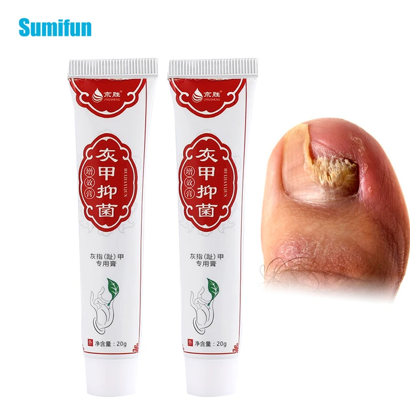 

20g Onychomycosis Anti Fungal Cream Natural Herbal Nail Repai Ointment Fingernails Toenail Remove Thick Gray Nail Repair Plaster