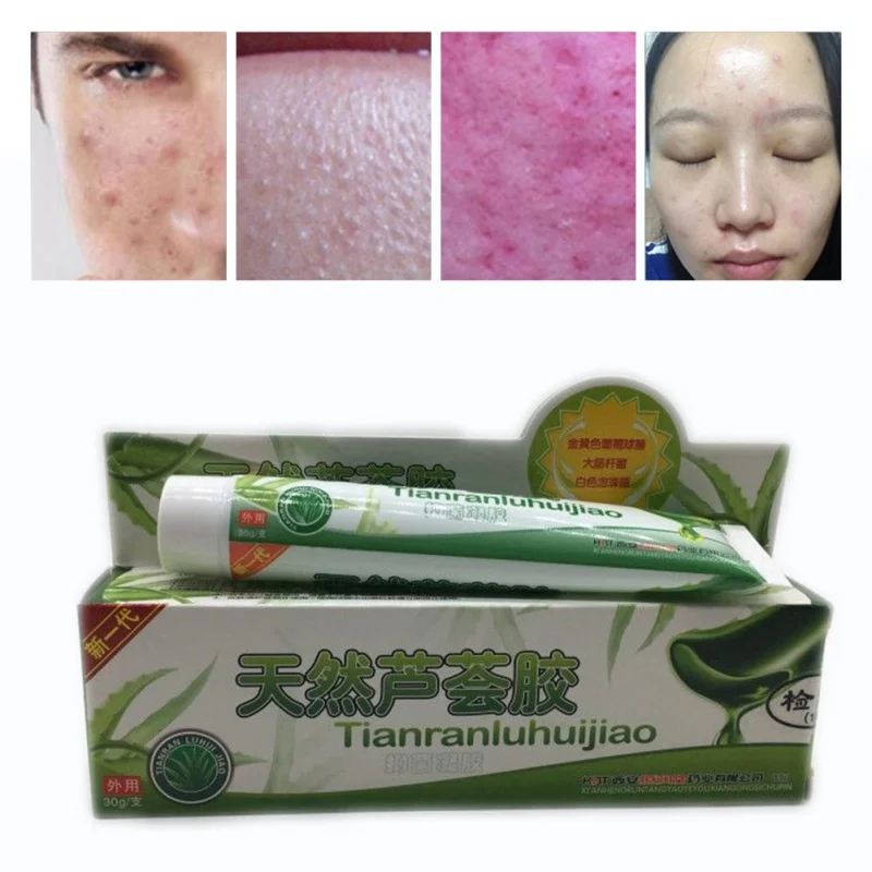 Увлажняющий гель с алоэ вера 30 мл | Красота и здоровье