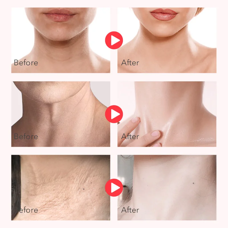 Крем от морщин отбеливающая лифтинговая маска с красным женьшенем 150 г