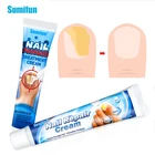 Крем для удаления грибка ногтей 2 типа, мазь для лечения грибковых ногтей онихомикоз, масло для лечения паронихии против инфекции ног и ног, мазь для ногтей от грибков