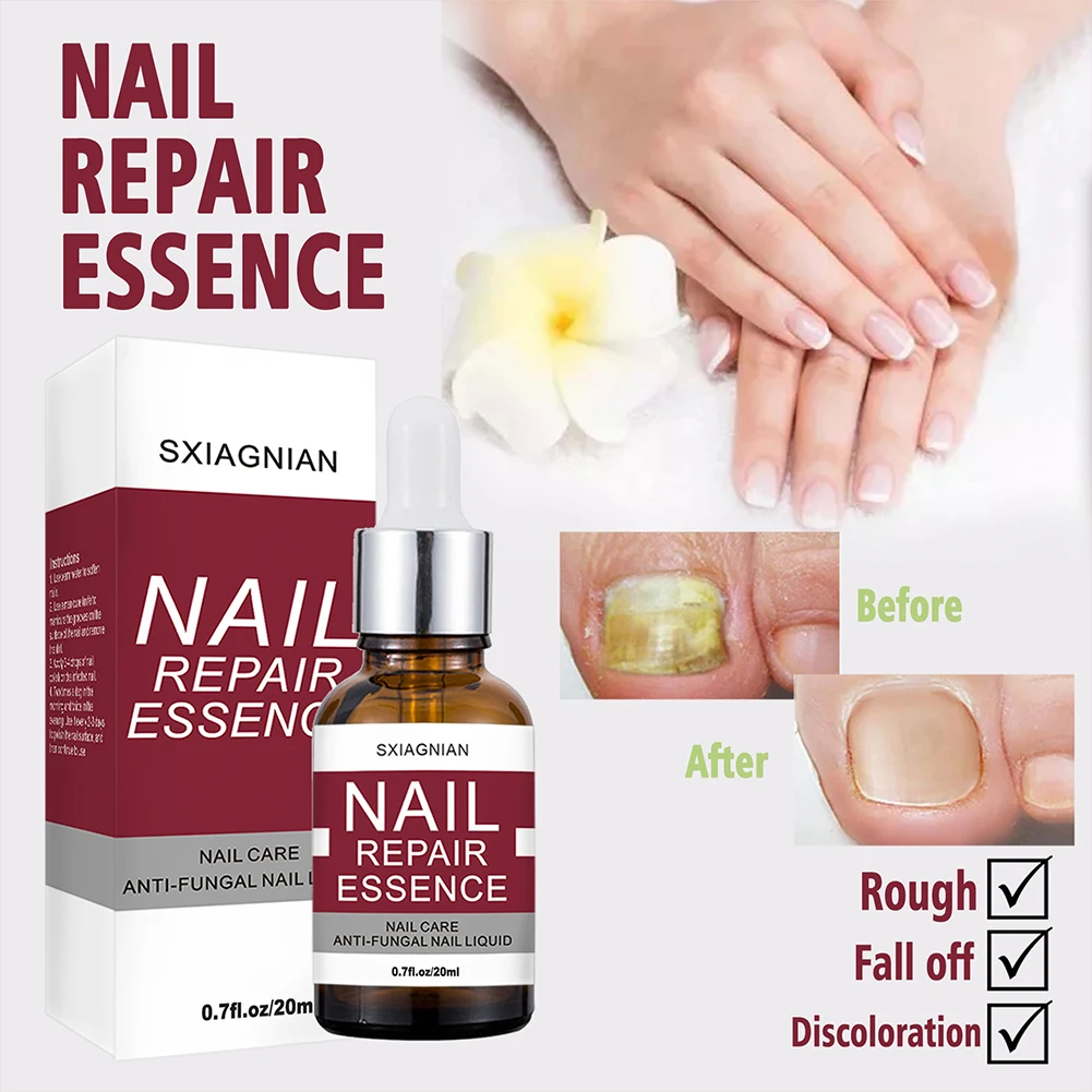 Nail Repair Essence Nail Fungus Treatment for Cracked Rough Fungal Nails Strengthen Damaged Nails of Fingernails Toenails