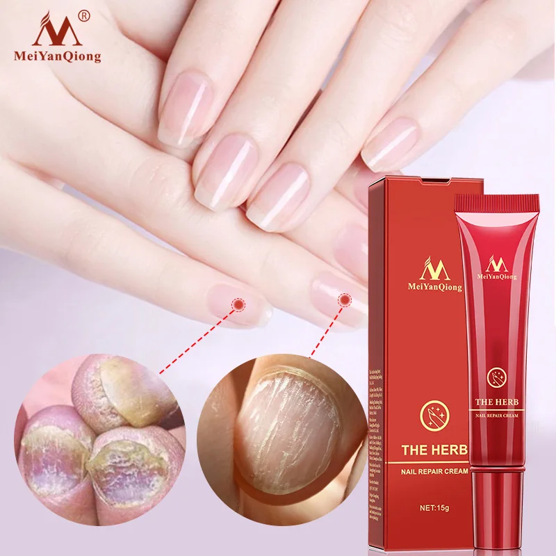 100% травяной восстанавливающий крем для ногтей противогрибковая инфекция