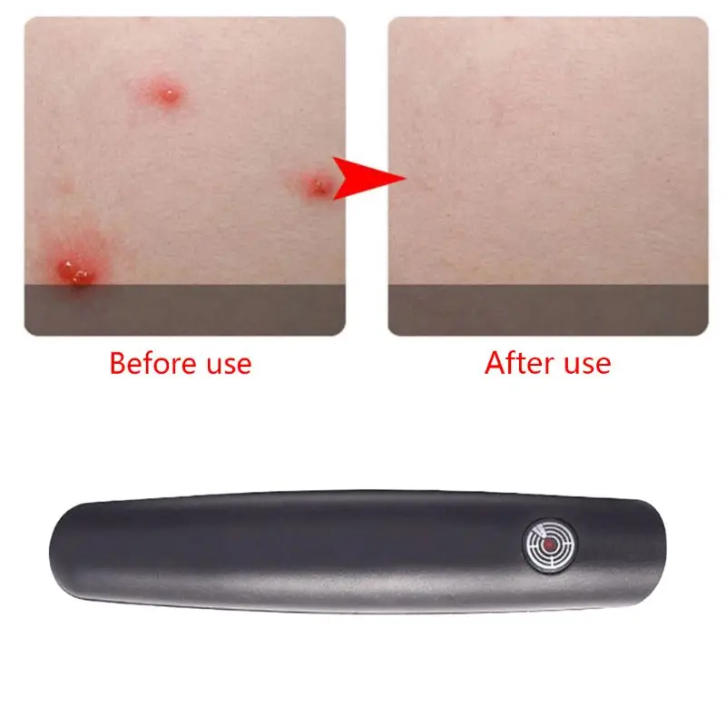 Summer Useful Outdoor Travel Bites Relieve Anti-Itch Pen Mosquito Insect Irritation Itching Reliever Helper for Children TOP | Спорт и