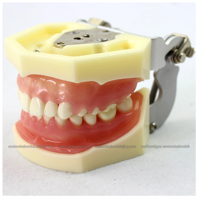 

12609 / Mild-Moderate Gum Disease Model With Gingival Replacement, Medical Science Teaching Anatomical Models