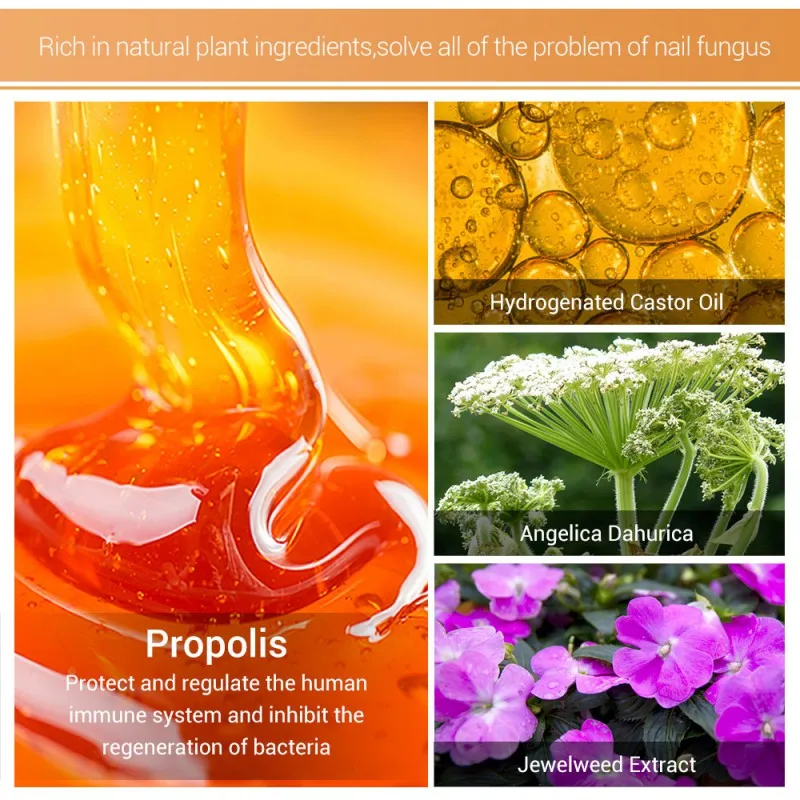 Натуральная антиинфекционная паронихия онихомикоз лечение грибковых ногтей