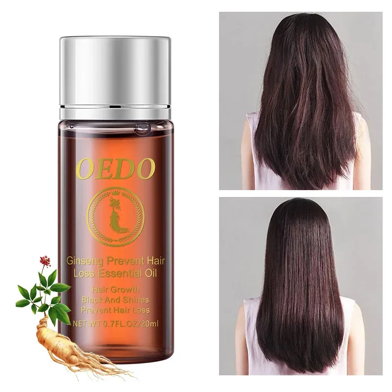 20 мл эфирное масло женьшеня для предотвращения выпадения волос стимулирует рост
