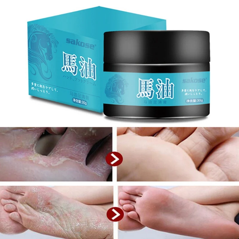 Крем для ног с конским маслом удаления омертвевшей кожи спортсмен средство ухода