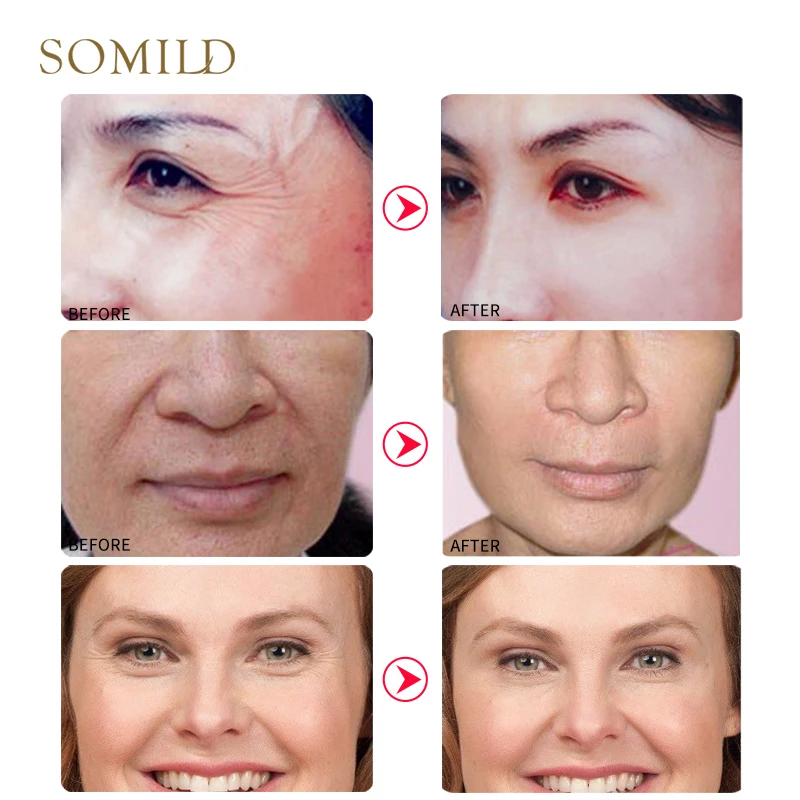 SOMILD набор для ухода за кожей против старения дорожный костюм Витамин Е лосьон