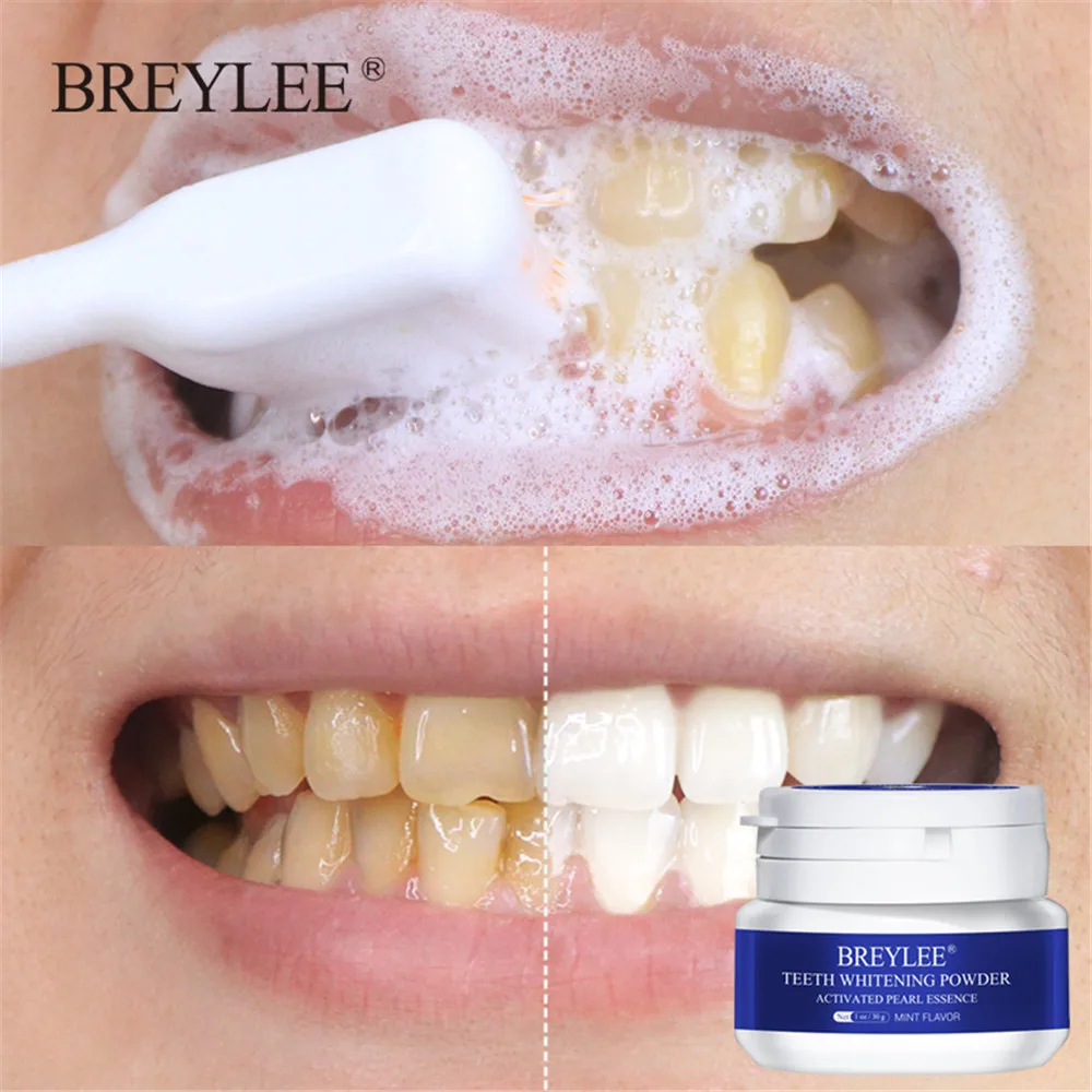 

Зубная паста BREYLEE для отбеливания зубов, прибор для удаления пятен от зубного налета, бриллиантовый гель для чистки зубов, 30 г