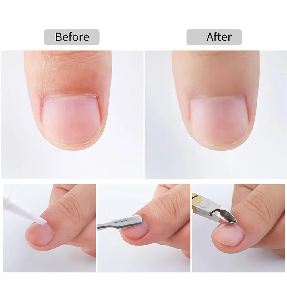 1cs нержавеющая сталь ногтей кутикулы толкатель средство для снятия УФ гель лака
