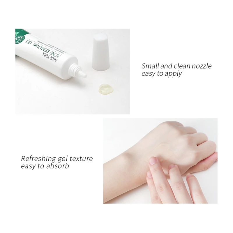 Крем-гель для лица с алоэ вера от акне увлажняющий крем 20 г |