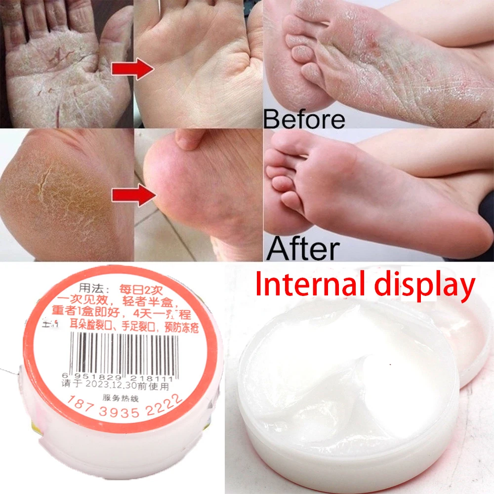 Китайский (традиционный) а так же 30 г жирных следов и сушка трещин крем для ног