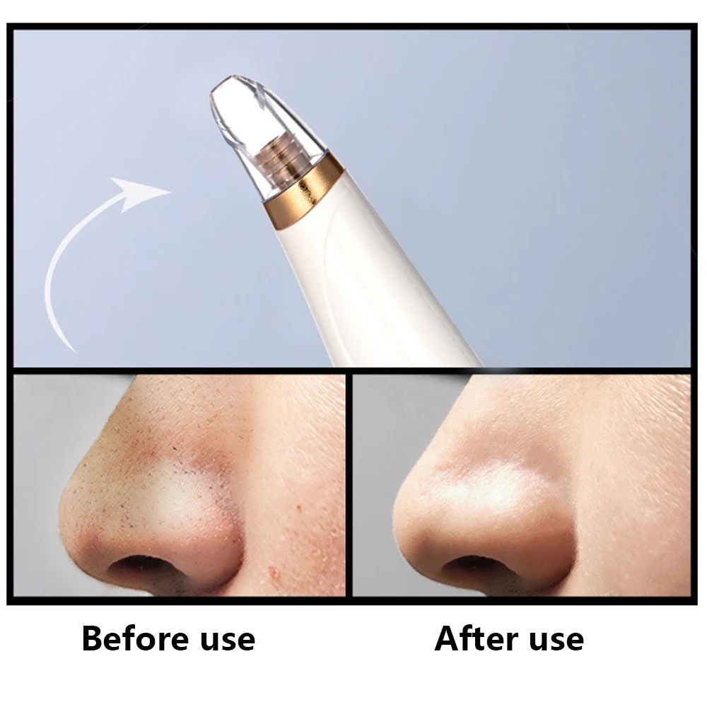 USB средство для удаления черных точек лица вакуумный уход за кожей очиститель пор