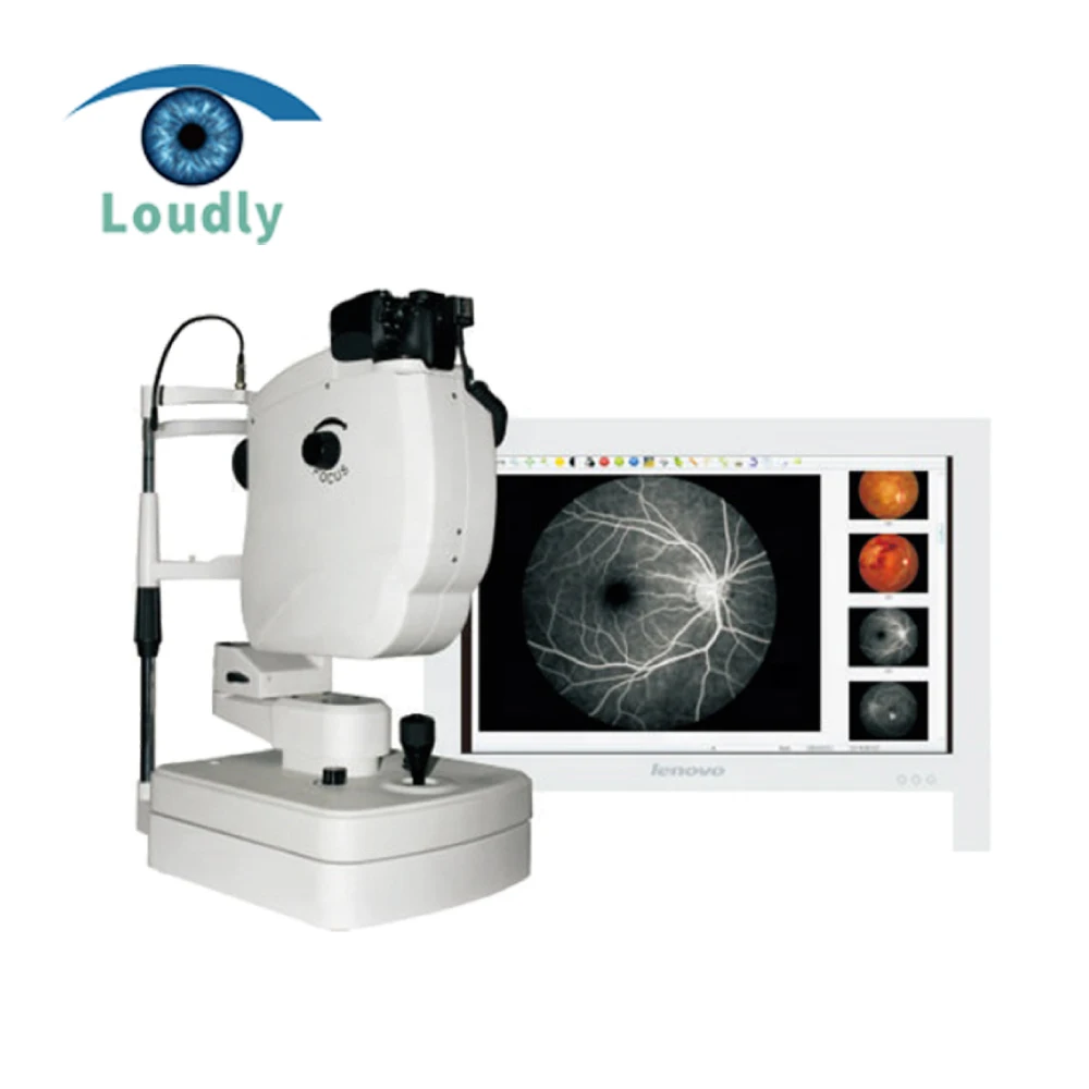 Громкий бренд офтальмологическое оборудование с немидрическим и FFA Fundus камера CE